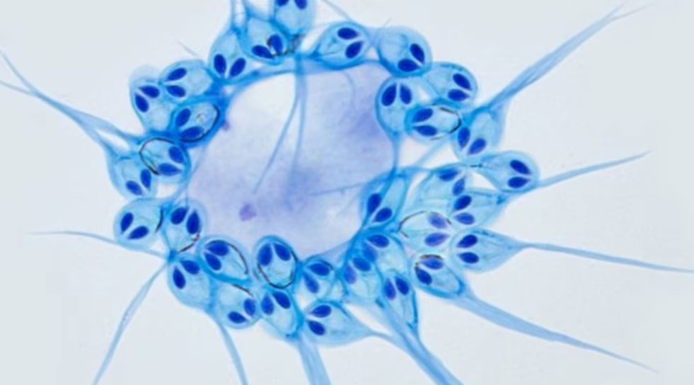 Henneguya-salminicola